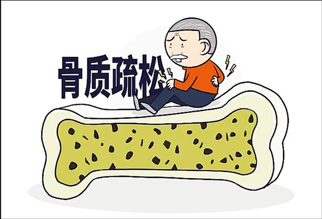 身體有這幾種狀況就是骨密度丟失的信號(hào).jpg