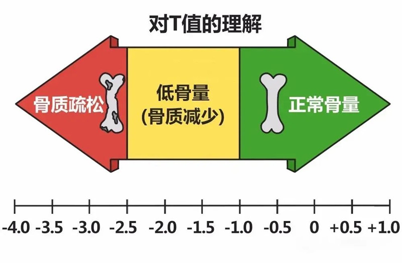 骨密度儀檢測.jpg